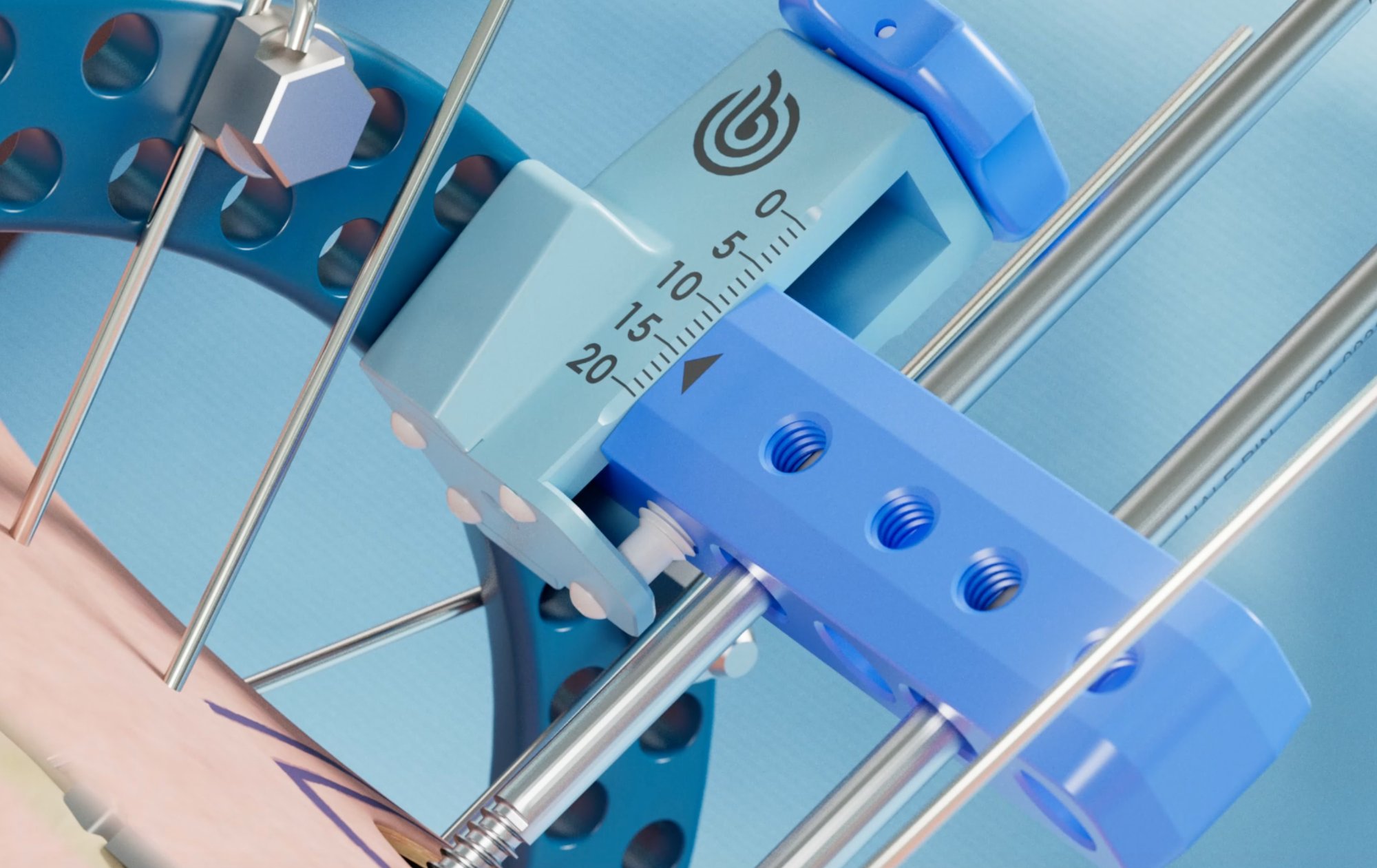 Excelsior System — Transport Mechanism